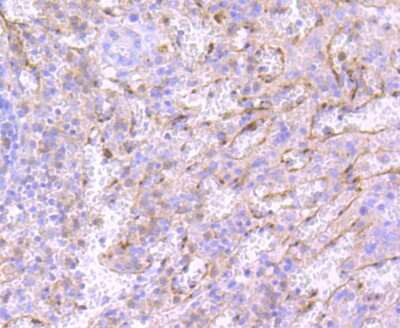 Immunohistochemistry-Paraffin: Neutrophil Elastase/ELA2 Antibody (JF098-6) [NBP2-66972] - Analysis of paraffin-embedded human spleen tissue using anti-Neutrophil Elastase antibody. Counter stained with hematoxylin.