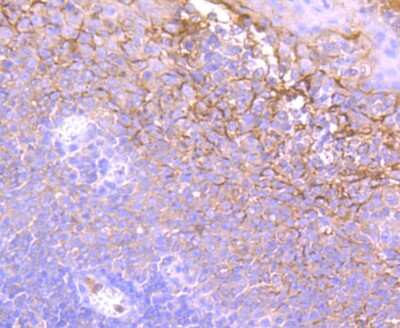 Immunohistochemistry-Paraffin: Neutrophil Elastase/ELA2 Antibody (JF098-6) [NBP2-66972] - Analysis of paraffin-embedded human tonsil tissue using anti-Neutrophil Elastase antibody. Counter stained with hematoxylin.