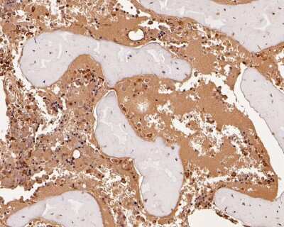 Immunohistochemistry-Paraffin: Neutrophil Elastase/ELA2 Antibody (JF098-6) [NBP2-66972] - Immunohistochemical analysis of paraffin-embedded human bone marrow tissue using anti-Neutrophil Elastase antibody. The section was pre-treated using heat mediated antigen retrieval with Tris-EDTA buffer (pH 8.0-8.4) for 20 minutes.The tissues were blocked in 5% BSA for 30 minutes at room temperature, washed with ddH2O and PBS, and then probed with the primary antibody (1/50) for 30 minutes at room temperature. The detection was performed using an HRP conjugated compact polymer system. DAB was used as the chromogen. Tissues were counterstained with hematoxylin and mounted with DPX.