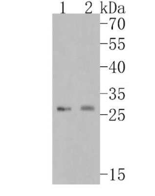 Western Blot: Neutrophil Elastase/ELA2 Antibody (JF098-6) [NBP2-66972] - Analysis of Neutrophil Elastase on different lysates. Proteins were transferred to a PVDF membrane and blocked with 5% BSA in PBS for 1 hour at room temperature. The primary antibody (1/500) was used in 5% BSA at room temperature for 2 hours. Goat Anti-Rabbit IgG - HRP Secondary Antibody at 1:5,000 dilution was used for 1 hour at room temperature. Positive control: Lane 1: Mouse spleen tissue lysateLane 2: Mouse bone marrow tissue lysate