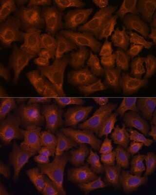 Immunocytochemistry/ Immunofluorescence Nexilin Antibody - Azide and BSA Free