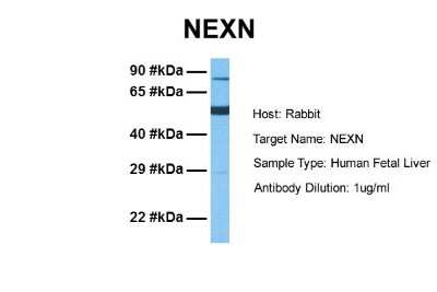 Western Blot Nexilin Antibody - BSA Free