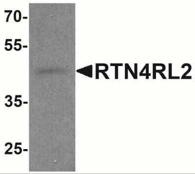 Western Blot: NgR2/NgRH1/RTN4RL2 Antibody [NBP2-41200] - Western blot analysis of RTN4RL2 in rat brain tissue lysate with RTN4RL2 antibody at 1 ug/mL.