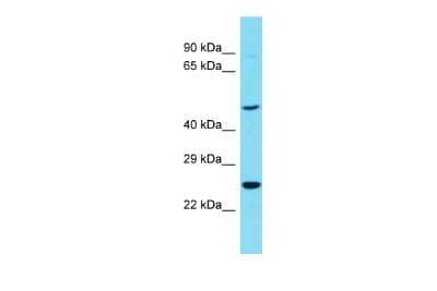 Western Blot: NgR3/NgRH2/RTN4RL1 Antibody [NBP3-09588] - Western blot analysis of NgR3/NgRH2/RTN4RL1 in OVCAR-3 Whole Cell lysates. Antibody dilution at 1.0ug/ml