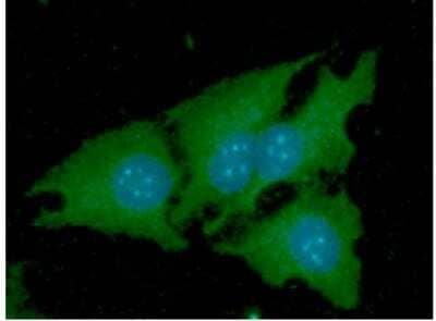 Immunocytochemistry/Immunofluorescence: Nicotinamide N-Methyltransferase/NNMT Antibody (AT11G11) [NBP2-50581] - ICC/IF analysis of NNMT in HeLa cells line, stained with DAPI (Blue) for nucleus staining and monoclonal anti-human NNMT antibody (1:100) with goat anti-mouse IgG-Alexa fluor 488 conjugate (Green).