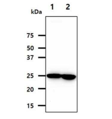 Western Blot: Nicotinamide N-Methyltransferase/NNMT Antibody (AT11G11) [NBP2-50581] - The cell lysates (40ug) were resolved by SDS-PAGE, transferred to PVDF membrane and probed with anti-human NNMT antibody (1:1000). Proteins were visualized using a goat anti-mouse secondary antibody conjugated to HRP and an ECL detection system. Lane 1.: HeLa cell lysate Lane 2.: A549 cell lysate