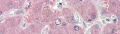 Immunohistochemistry: Nicotinamide N-Methyltransferase/NNMT Antibody [NBP1-55398] - Human Adult Liver Observed Staining: Cytoplasm in hepatocytes Primary Antibody Concentration: 1 : 600 Secondary Antibody: Donkey anti-Rabbit-Cy3 Secondary Antibody Concentration: 1 : 200 Magnification: 20X Exposure Time: 0.5 2.0 sec.
