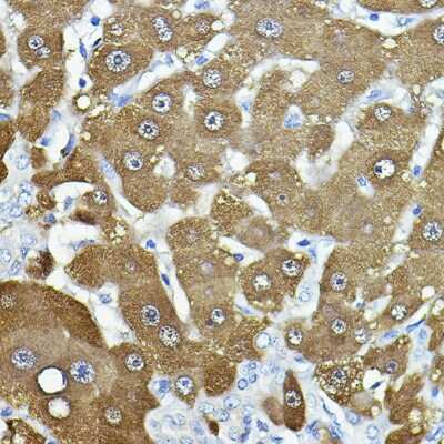 Immunohistochemistry-Paraffin: Nicotinamide N-Methyltransferase/NNMT Antibody [NBP3-03406] - Immunohistochemistry of paraffin-embedded human liver using [KO Validated] Nicotinamide N-Methyltransferase/NNMT Rabbit pAb (NBP3-03406) at dilution of 1:100 (40x lens). Perform high pressure antigen retrieval with 10 mM citrate buffer pH 6.0 before commencing with IHC staining protocol.