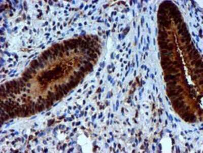 Immunohistochemistry: Nicotinamide N-Methyltransferase/NNMT Antibody (OTI3D8) - Azide and BSA Free [NBP2-72984] - Staining of paraffin-embedded Human endometrium tissue using anti-NNMT mouse monoclonal antibody.