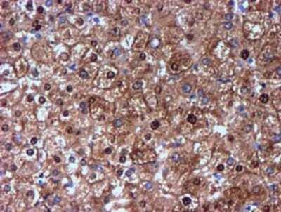 Immunohistochemistry: Nicotinamide N-Methyltransferase/NNMT Antibody (OTI3D8) - Azide and BSA Free [NBP2-72984] - Staining of paraffin-embedded Human liver tissue using anti-NNMT mouse monoclonal antibody.