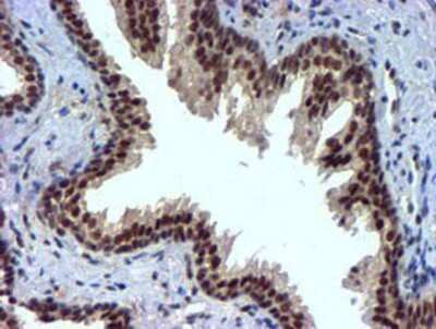 Immunohistochemistry: Nicotinamide N-Methyltransferase/NNMT Antibody (OTI3D8) - Azide and BSA Free [NBP2-72984] - Staining of paraffin-embedded Human prostate tissue using anti-NNMT mouse monoclonal antibody.