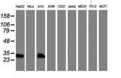 Western Blot: Nicotinamide N-Methyltransferase/NNMT Antibody (OTI3D8) - Azide and BSA Free [NBP2-72984] - Analysis of extracts (35ug) from 9 different cell lines by using anti-NNMT monoclonal antibody.