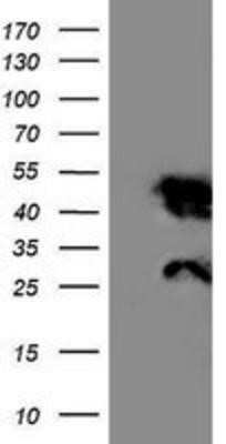 Western Blot Nicotinamide N-Methyltransferase/NNMT Antibody (OTI3D8) - Azide and BSA Free