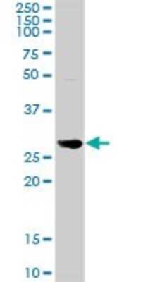 Western Blot: Nicotinamide N-Methyltransferase/NNMT Antibody [H00004837-D01P] - Analysis of NNMT expression in mouse lung.