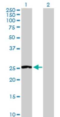 Western Blot: Nicotinamide N-Methyltransferase/NNMT Antibody [H00004837-D01P] - Analysis of NNMT expression in transfected 293T cell line by NNMT polyclonal antibody.Lane 1: NNMT transfected lysate(29.60 KDa).Lane 2: Non-transfected lysate.