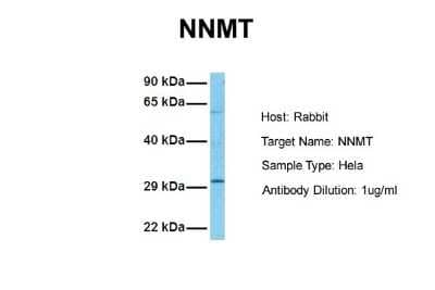 Western Blot: Nicotinamide N-Methyltransferase/NNMT Antibody [NBP1-55398] - Sample Tissue: Human Hela Antibody Dilution: 1.0 ug/ml