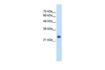 Western Blot: Nicotinamide N-Methyltransferase/NNMT Antibody [NBP1-55398] - Reccomended Titration: 2.5 ug/ml Positive Control: HepG2 cell lysate