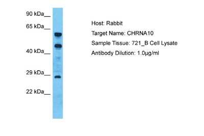 Western Blot: Nicotinic Acetylcholine R alpha 10/CHRNA10 Antibody [NBP2-86730] - Host: Rabbit. Target Name: CHRNA10. Sample Type: 721_B Whole Cell lysates. Antibody Dilution: 1.0ug/ml