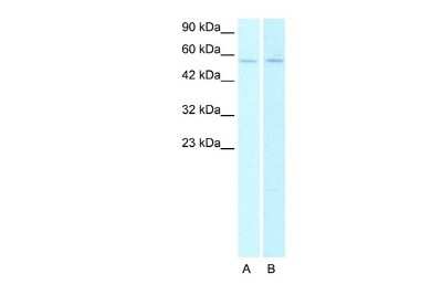 Western Blot: Nicotinic Acetylcholine R alpha 2/CHRNA2 Antibody [NBP1-79957] - Lane A: HepG2 cell lysates Lane B: Raji cell lysates, Antibody Dilution: 0.5 ug/ml.