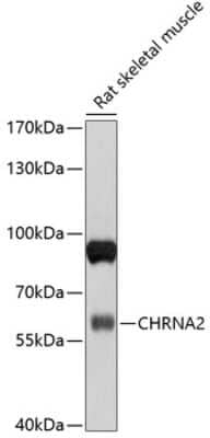 Western Blot: Nicotinic Acetylcholine R alpha 2/CHRNA2 Antibody [NBP2-94552] - Analysis of extracts of rat skeletal muscle, using Nicotinic Acetylcholine R alpha 2/CHRNA2 at 1:1000 dilution.Secondary antibody: HRP Goat Anti-Rabbit IgG (H+L) at 1:10000 dilution.Lysates/proteins: 25ug per lane.Blocking buffer: 3% nonfat dry milk in TBST.Detection: ECL Basic Kit .Exposure time: 10s.