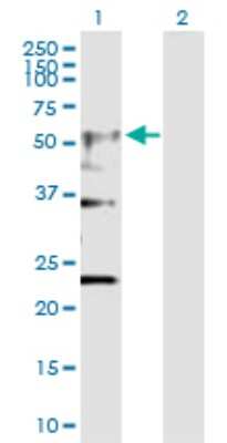 Western Blot: Nicotinic Acetylcholine R alpha 4/CHRNA4 Antibody [H00001137-D01P] - Analysis of CHRNA4 expression in transfected 293T cell line by CHRNA4 polyclonal antibody.Lane 1: CHRNA4 transfected lysate(49.90 KDa).Lane 2: Non-transfected lysate.