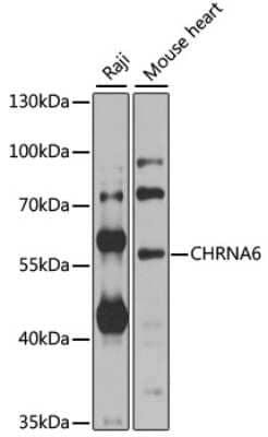 Western Blot: Nicotinic Acetylcholine R alpha 6/CHRNA6 Antibody [NBP2-94679] - Analysis of extracts of various cell lines, using Nicotinic Acetylcholine R alpha 6/CHRNA6 at 1:1000 dilution.Secondary antibody: HRP Goat Anti-Rabbit IgG (H+L) at 1:10000 dilution.Lysates/proteins: 25ug per lane.Blocking buffer: 3% nonfat dry milk in TBST.Detection: ECL Basic Kit .Exposure time: 10s.