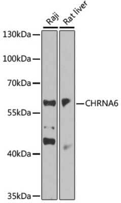 Western Blot: Nicotinic Acetylcholine R alpha 6/CHRNA6 Antibody [NBP2-94824] - Analysis of extracts of various cell lines, using Nicotinic Acetylcholine R alpha 6/CHRNA6 at 1:1000 dilution.Secondary antibody: HRP Goat Anti-Rabbit IgG (H+L) at 1:10000 dilution.Lysates/proteins: 25ug per lane.Blocking buffer: 3% nonfat dry milk in TBST.Detection: ECL Basic Kit .Exposure time: 30s.