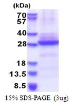 SDS-Page: Nicotinic Acetylcholine R alpha 6/CHRNA6 Recombinant Protein [NBP2-51586] - 15% SDS Page (3 ug)