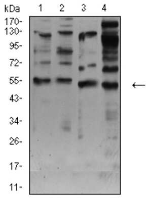 Western Blot: Nicotinic Acetylcholine R alpha 7/CHRNA7 Antibody (7F10F1) [NBP2-61738] - Analysis using CHRNA7 mouse mAb against membrane protein lysate of C6 (1), membrane protein lysate of SK-N-SH (2), C6 (3), and HepG2 (4) cell lysate.
