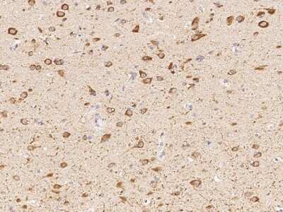 Immunohistochemistry-Paraffin: Nicotinic Acetylcholine R alpha 7/CHRNA7 Antibody [NBP2-99069] - Immunochemical staining of human Nicotinic Acetylcholine R alpha 7/CHRNA7 in human brain with rabbit polyclonal antibody (1:1000, formalin-fixed paraffin embedded sections).
