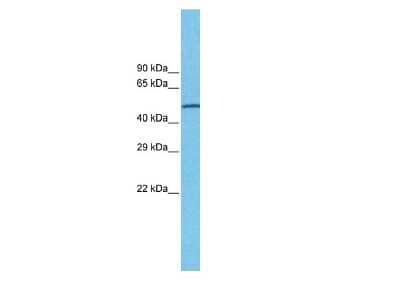 Western Blot: Nicotinic Acetylcholine R alpha 7/CHRNA7 Antibody [NBP1-79948] - MDA-MB-435S Cell lysates, Antibody Dilution: 1.0 ug/ml.