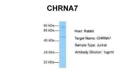 Western Blot: Nicotinic Acetylcholine R alpha 7/CHRNA7 Antibody [NBP1-79948] - Sample Tissue: Human Jurkat Antibody Dilution: 1.0 ug/ml