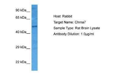 Western Blot Nicotinic Acetylcholine R alpha 7/CHRNA7 Antibody - BSA Free