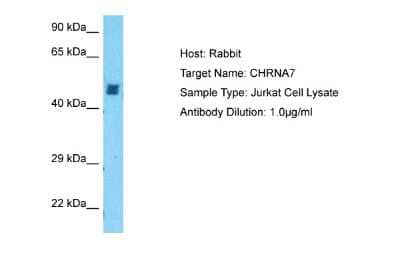 Western Blot: Nicotinic Acetylcholine R alpha 7/CHRNA7 Antibody [NBP1-79948] - Host: Rabbit. Target Name: CHRNA7. Sample Tissue: Human Jurkat Whole Cell. Antibody Dilution: 1ug/ml