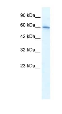 Western Blot: Nicotinic Acetylcholine R alpha 7/CHRNA7 Antibody [NBP1-80092] - Jurkat cell lysate, concentration 1.25ug/ml.