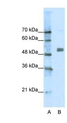 Western Blot Nicotinic Acetylcholine R alpha 9/CHRNA9 Antibody - BSA Free