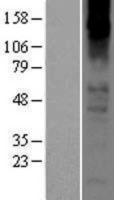 Western Blot Nicotinic Acetylcholine R alpha 2/CHRNA2 Overexpression Lysate