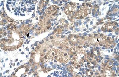 Immunohistochemistry: Nicotinic Acetylcholine Receptor beta 2 Antibody [NBP2-82288] - Human kidney