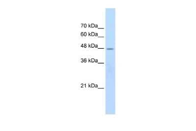 Western Blot: Nicotinic Acetylcholine Receptor beta 2 Antibody [NBP2-82288] - WB Suggested Anti-CHRNB2 Antibody Titration: 2.5ug/ml. Positive Control: Jurkat cell lysateCHRNB2 is supported by BioGPS gene expression data to be expressed in Jurkat