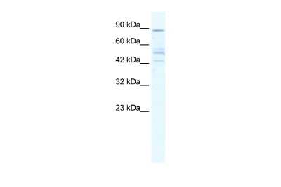 Western Blot: Nicotinic Acetylcholine Receptor beta 2 Antibody [NBP2-82289] - WB Suggested Anti-CHRNB2 Antibody Titration: 5.0ug/ml. ELISA Titer: 1:312500. Positive Control: HepG2 cell lysate