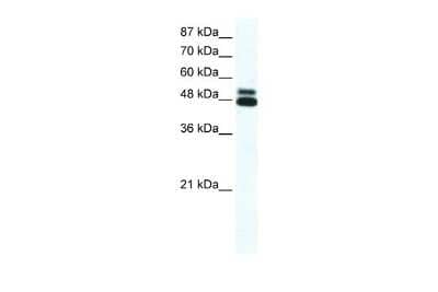 Western Blot: Nicotinic Acetylcholine Receptor beta 2 Antibody [NBP2-82290] - WB Suggested Anti-CHRNB2 Antibody Titration: 0.2-1 ug/ml. ELISA Titer: 1:62500. Positive Control: HepG2 cell lysate