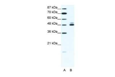 Western Blot: Nicotinic Acetylcholine Receptor beta 2 Antibody [NBP2-82291] - WB Suggested Anti-CHRNB2 Antibody. Titration: 1.25 ug/ml. Positive Control: HepG2 Whole Cell