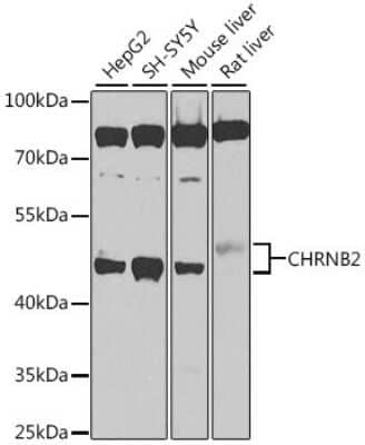 Western Blot: Nicotinic Acetylcholine Receptor beta 2 Antibody [NBP2-93318] - Analysis of extracts of various cell lines, using Nicotinic Acetylcholine Receptor beta 2 at 1:1000 dilution.Secondary antibody: HRP Goat Anti-Rabbit IgG (H+L) at 1:10000 dilution.Lysates/proteins: 25ug per lane.Blocking buffer: 3% nonfat dry milk in TBST.Detection: ECL Basic Kit .Exposure time: 90s.