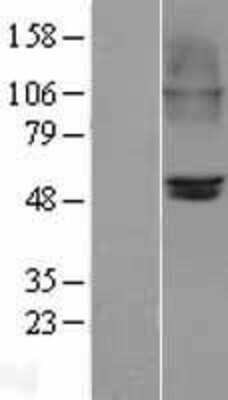 Western Blot: Nicotinic Acetylcholine Receptor beta 2 Overexpression Lysate (Adult Normal) [NBL1-09187] Left-Empty vector transfected control cell lysate (HEK293 cell lysate); Right -Over-expression Lysate for Nicotinic Acetylcholine Receptor beta 2.