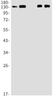 Western Blot: Nidogen-1/Entactin Antibody (S08-3H3) [NBP3-19860] - Western blot detection of Nidogen-1/Entactin in Hela (Lane 1), A549 (Lane 2), HL-60 (Lane 3), U251 (Lane 4), U87-MG (Lane 5) cell lysates using NBP3-19860 (1:1000 diluted). Predicted band size: 136kDa. Observed band size: 136kDa.