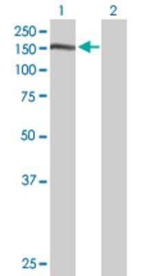 Western Blot: Nidogen-1/Entactin Antibody [H00004811-D01P] - Analysis of NID1 expression in transfected 293T cell line by NID1 polyclonal antibody.Lane 1: NID1 transfected lysate(122.10 KDa).Lane 2: Non-transfected lysate.