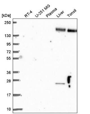 Western Blot: Nidogen-2 Antibody [NBP2-55427] - Western blot analysis in human cell line RT-4, human cell line U-251 MG, human plasma, human liver tissue and human tonsil tissue.