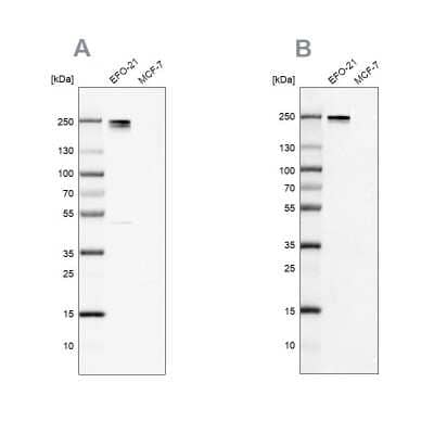 <b>Independent Antibodies Validation. </b>Western Blot: Nidogen-2 Antibody [NBP2-55427] - Analysis using Anti-NID2 antibody NBP2-55427 (A) shows similar pattern to independent antibody NBP2-49045 (B).