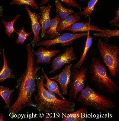 Immunocytochemistry/Immunofluorescence: Niemann-Pick C1 Antibody (1318A) - Azide and BSA Free [NBP2-80879] - HeLa cells were fixed and permeabilized for 10 minutes using -20C MeOH. The cells were incubated with anti-Niemann-Pick C1 Antibody (1318A) at 2 ug/ml overnight at 4C and detected with an anti-rabbit Dylight 488 (Green) at a 1:500 dilution. Alpha tubulin (DM1A) NB100-690 was used as a co-stain at a 1:1000 dilution and detected with an anti-mouse Dylight 550 (Red) at a 1:500 dilution. Nuclei were counterstained with DAPI (Blue). Cells were imaged using a 40X objective. Image from the standard format of this antibody.