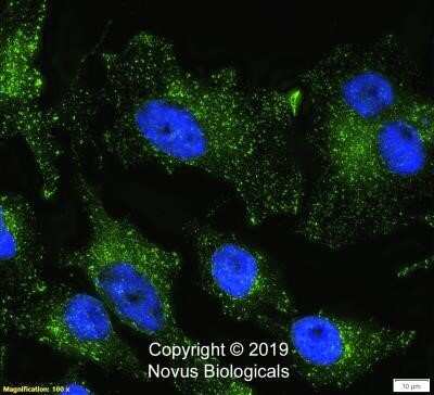 Immunocytochemistry/Immunofluorescence: Niemann-Pick C1 Antibody (1318A) - Azide and BSA Free [NBP2-80879] - HeLa cells were fixed in 4% paraformaldehyde for 10 min and permeabilized in 0.05% Triton X-100 for 5 minutes. The cells were incubated with anti- Niemann-Pick C1 Antibody at 2 ug/ml for 60 minutes at room temperature and detected with an anti-rabbit Dylight 488 (Green) at a 1:1000 dilution for 60 minutes. Nuclei were counterstained with DAPI (Blue). Cells were imaged using a 100X objective and digitally deconvolved. Image from the standard format of this antibody.